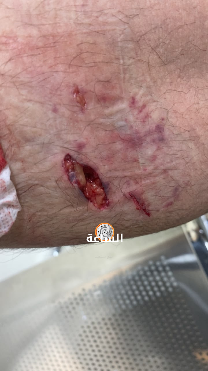 Madar Al-Saa Images 0.9805924481160044