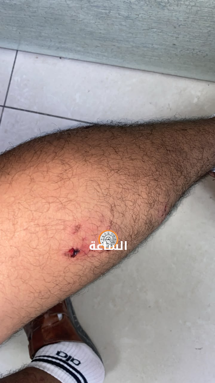 Madar Al-Saa Images 0.5498051353039076