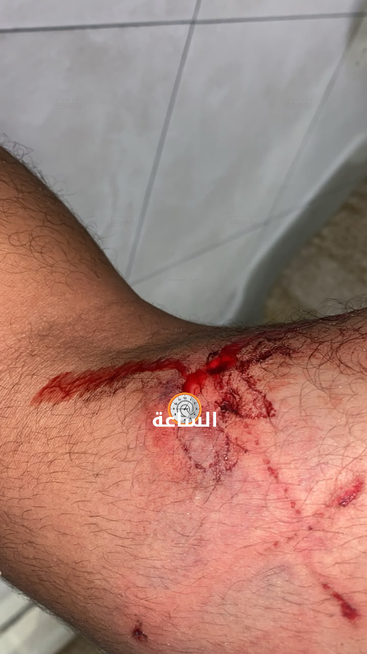 Madar Al-Saa Images 0.7972270250789786
