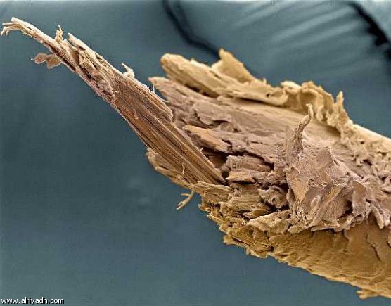 9 أسباب لتقصف الشعر