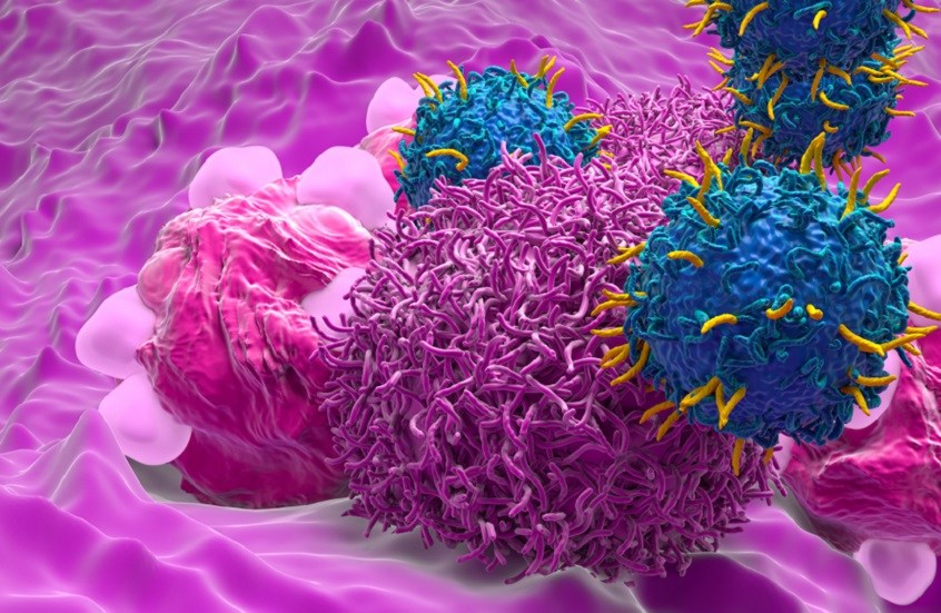 خطر خفي يواجه الناجيات من سرطان