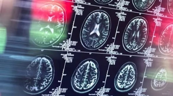 رذاذ للأنف يقدم الطريقة الأولى لعلاج