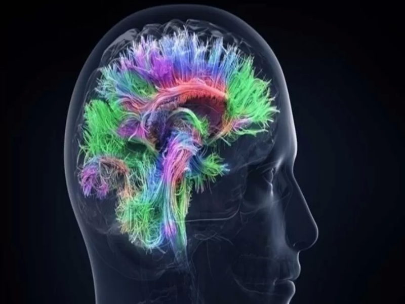 أدمغة المبدعين لديها شبكات اتصال فريدة