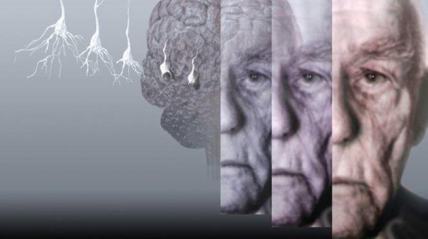 النشاط يحسن ذاكرة مرضى الخرف