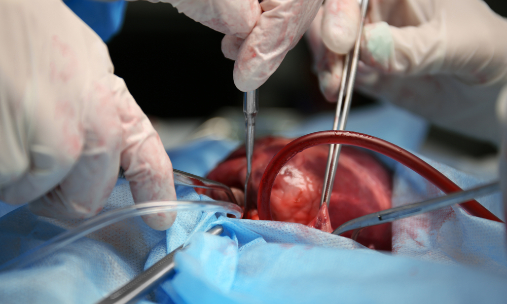 سرقوا حتى جلودهم.. هذا ما يفعله