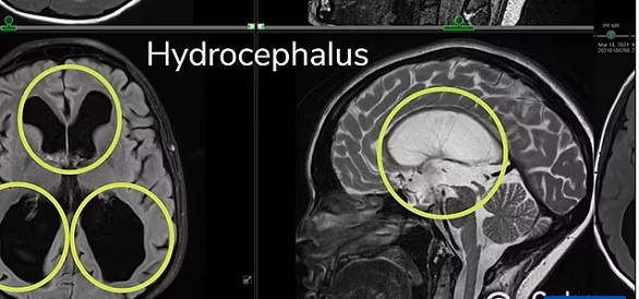 تشخيص خاطئ يدخل شابة إلى مستشفى