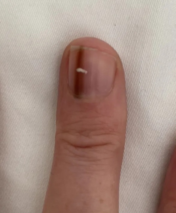 ليست البيضاء بل البنية.. تكتشف إصابتها