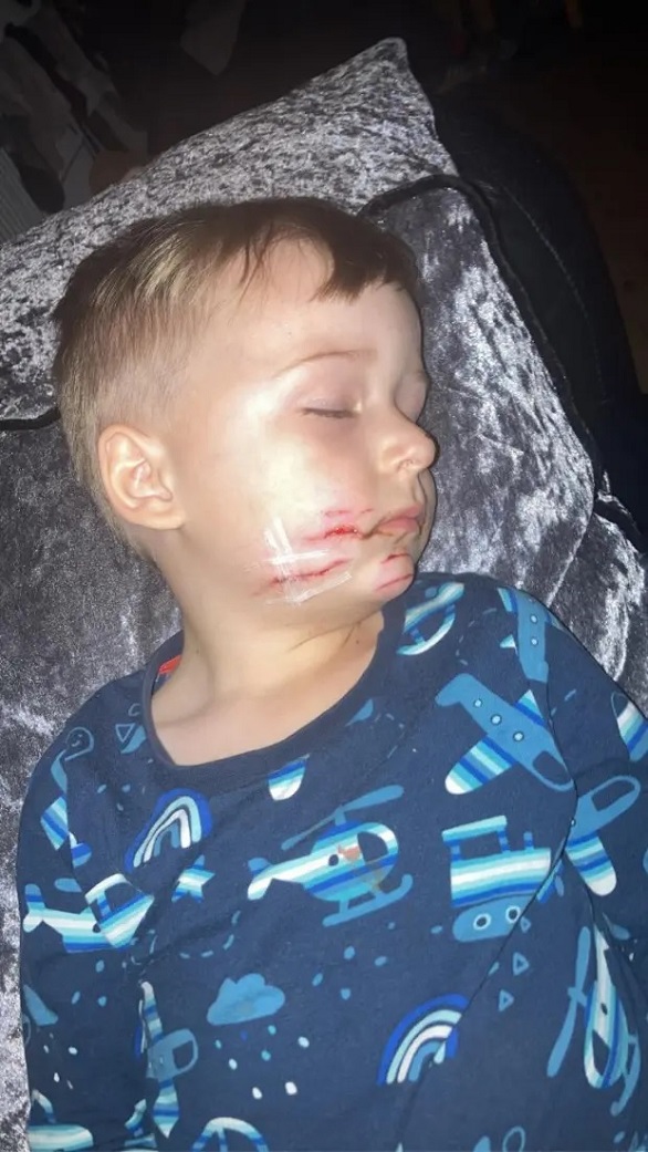 طفل ينجو من الموت بفضل جراحة