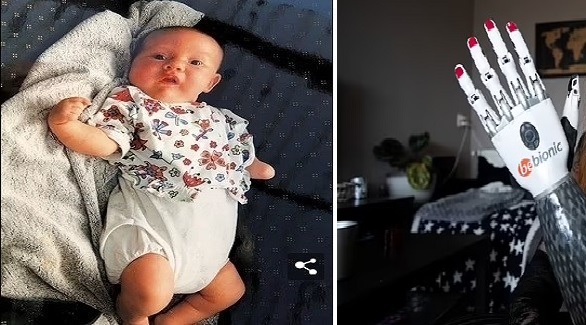 تتحدى إعاقتها وتتعلم التزلج ورفع الأثقال