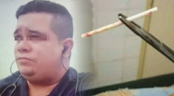 طبيب مزيف يزرع عصا مصاصة تحت