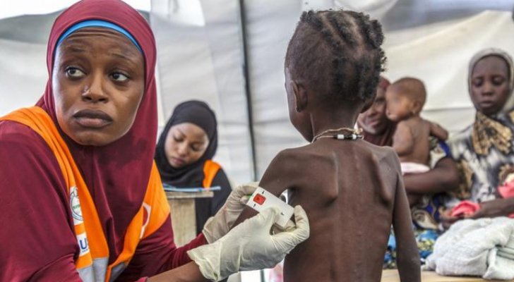 الأمم المتحدة تحذّر: سوء التغذية الحاد