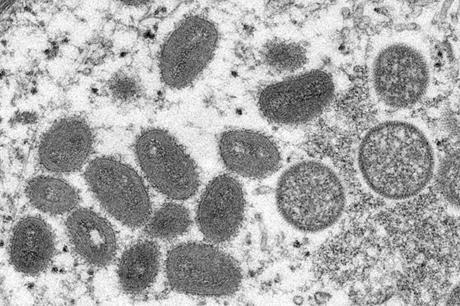 خريطة انتشار جدري القرود بالعالم