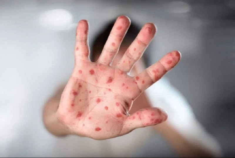 الصحة: التبليغ الفوري في عن أي