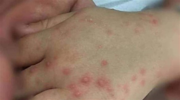 ماليزيا تغلق عشرات رياض الأطفال بعد