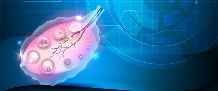 هذه الأعراض تنذر بسرطان عنق الرحم