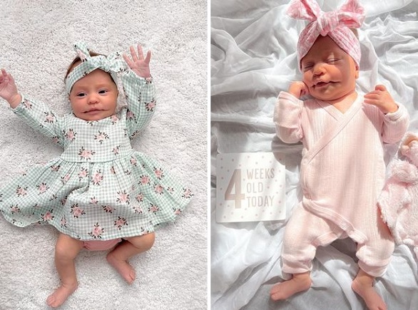 طفلة تولد بابتسامة دائمة بسبب حالة