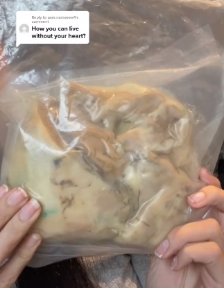 تحتفظ بقلبها القديم في حقيبة بلاستيكية