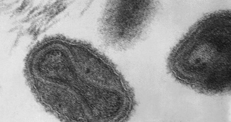الصحة العالمية: من المستبعد تحوّل جدري