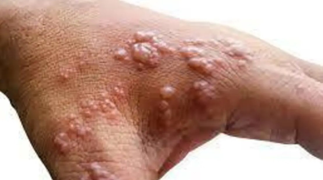 قلق جديد.. هذه الأشياء قد تسبب