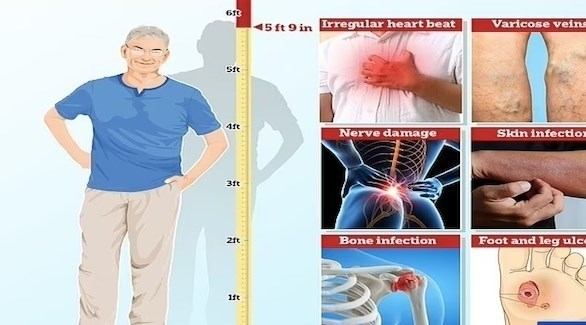 الأشخاص الذين يتجاوز طولهم 179 سم