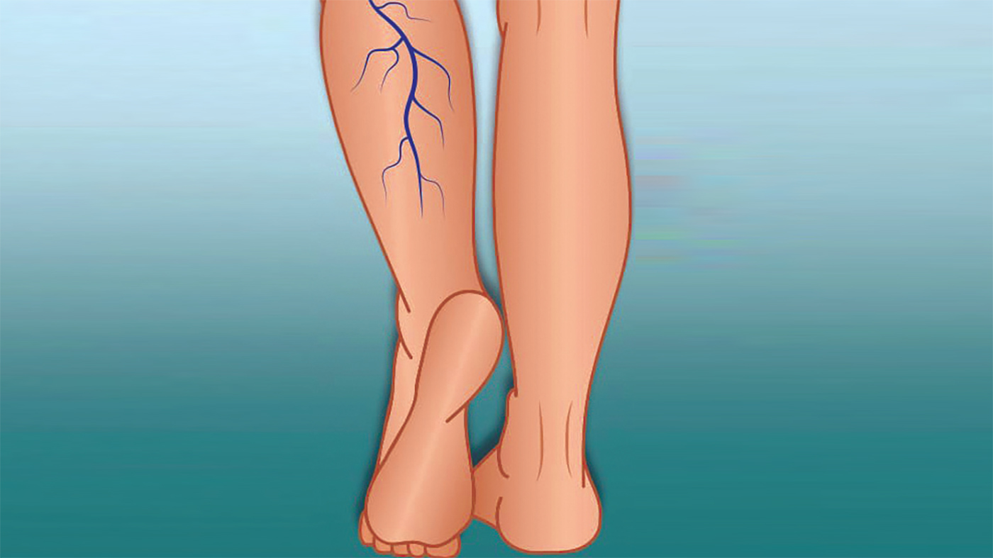 البقع الحمراء على الساقين .. علام