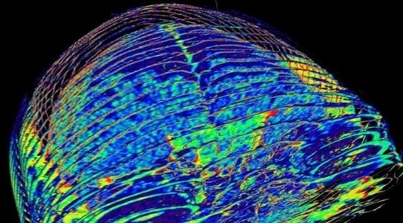 ما علاقة انكماش الذناغ بفقدان الشهية؟