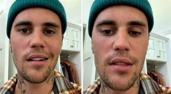 أصابته هو من بين 100 الف