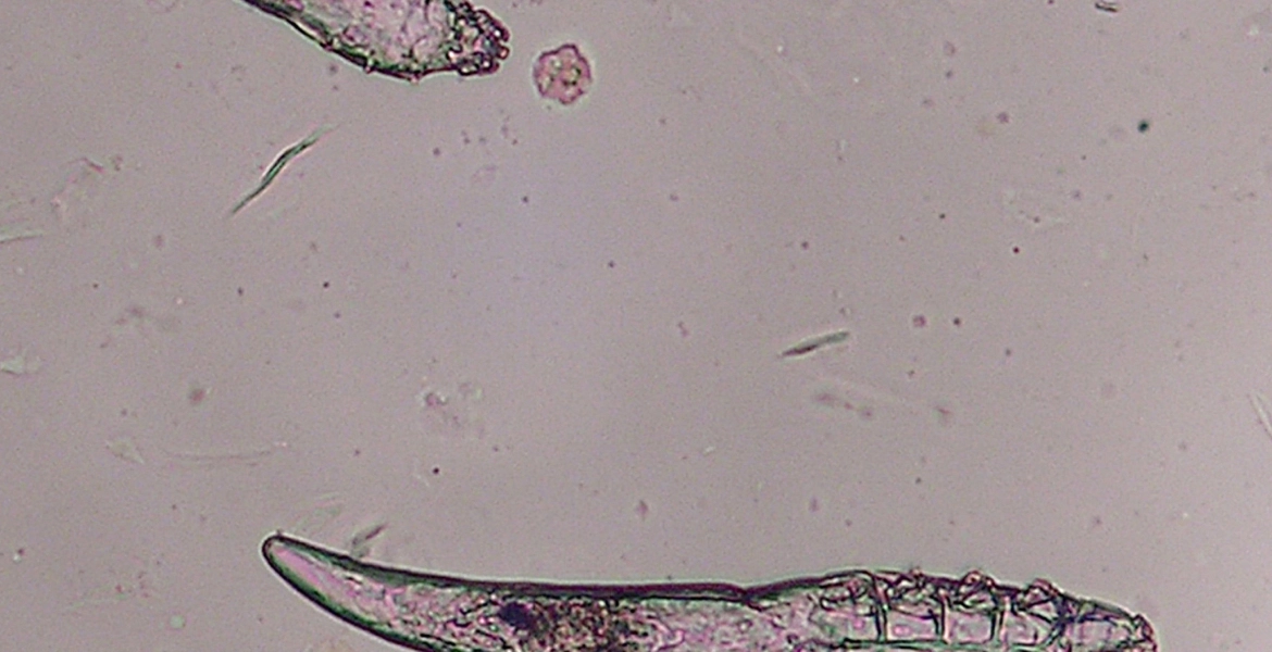 تتزاوج على جبهاتنا وأنوفنا في الليل