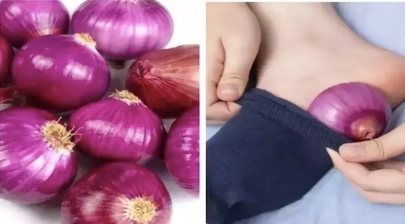 ما هي فوائد وضع شرائح البصل