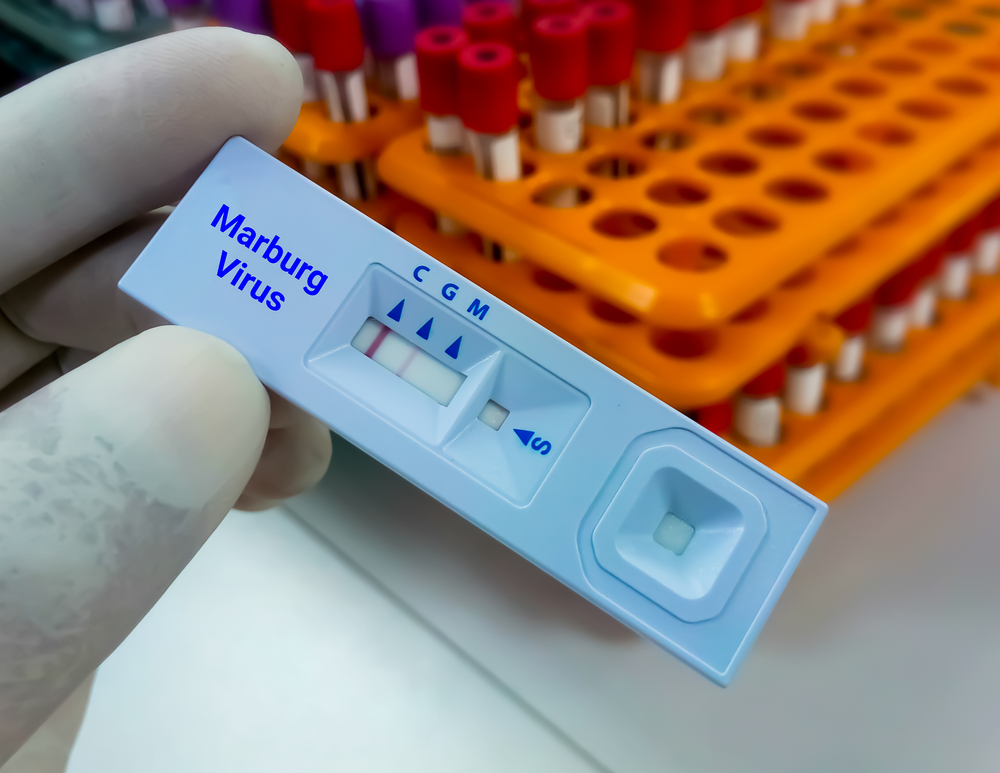 يحول البشر إلى “أشباح” وقد تبلغ