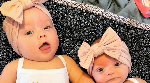 تنجب طفلتين توأم إحداهما أصغر بثلاث