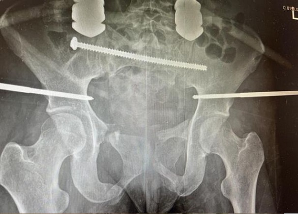 تنجو بأعجوبة بعدما كادت تقطع من