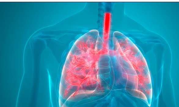 لماذا يجب الامتناع عن استخدام القوارير