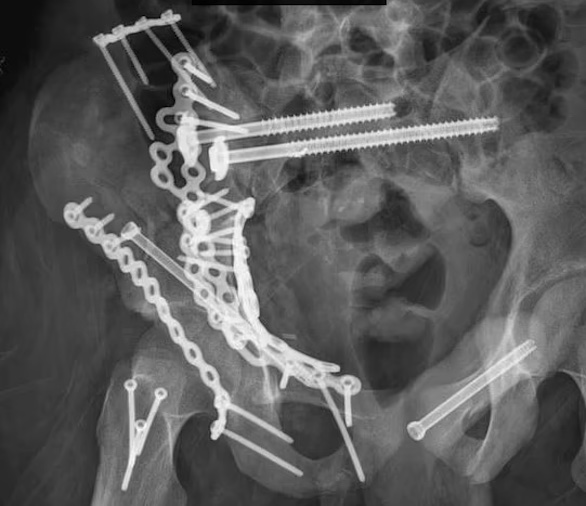 انسلخ وجهه بسبب عقار مخدر