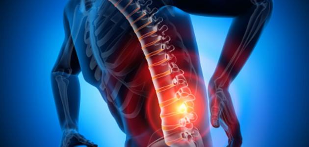 لعلاج آلام الظهر في 10 دقائق