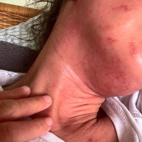 تمتنع عن مغادرة المنزل بسبب كريم