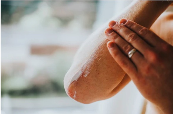 كيف تؤثر علاجات السرطان على البشرة