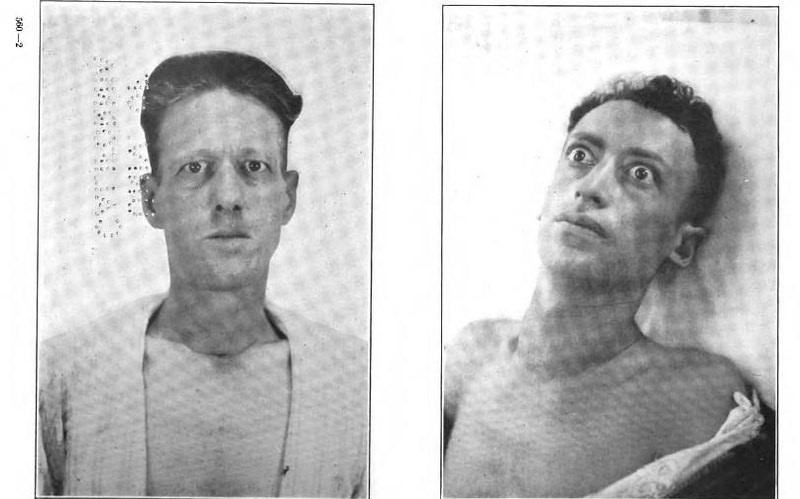 ظهر فجأة واختفى فجأة.. وباء “مرض