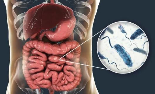 69 إصابة بالكوليرا في لبنان