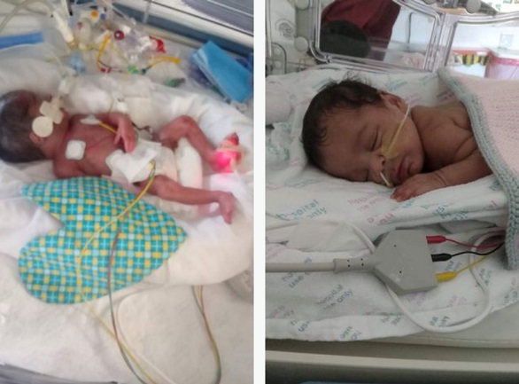 طفل معجزة يعود للحياة بعدما توقف