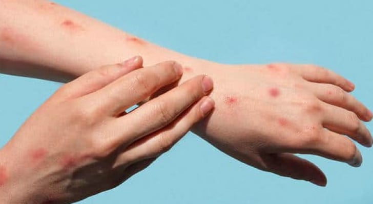 الصحة العالمية تبقي على أعلى مستوى