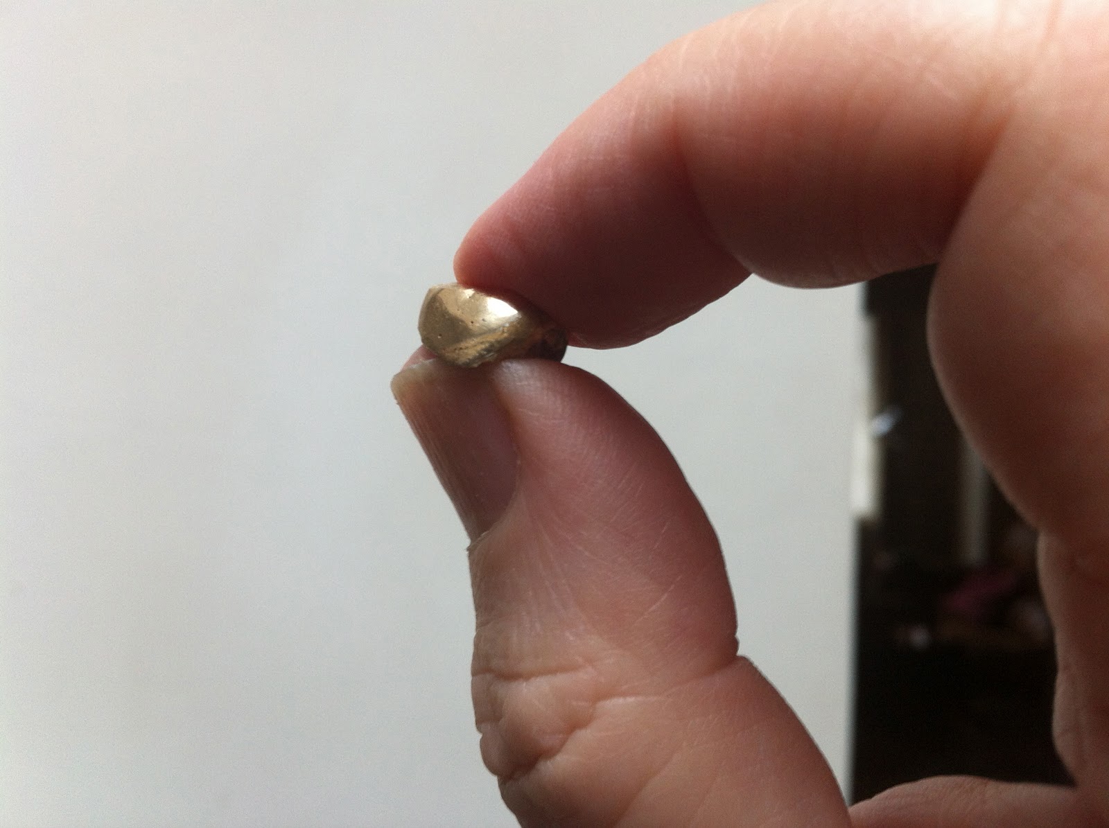 ممرض يسرق ضرسا ذهبيا من فم