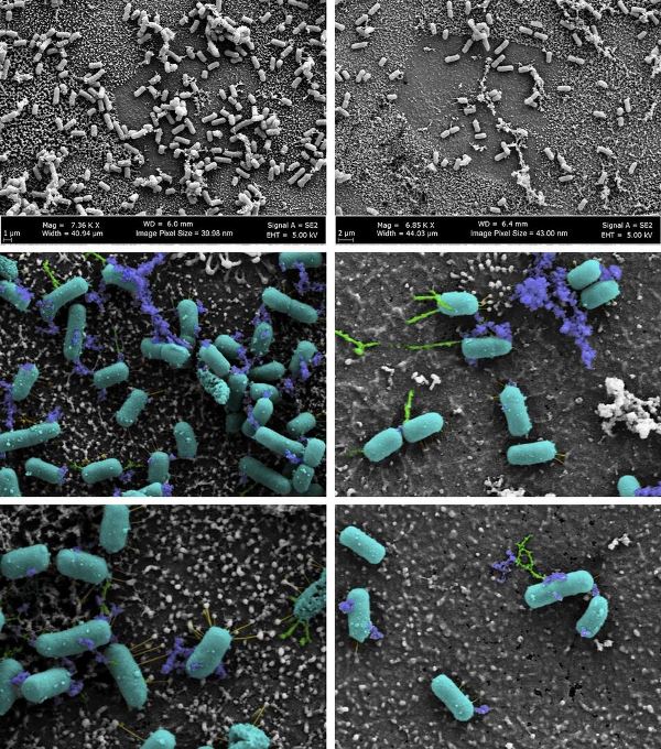 تحذيرات في تونس من بكتيريا شيغيلا