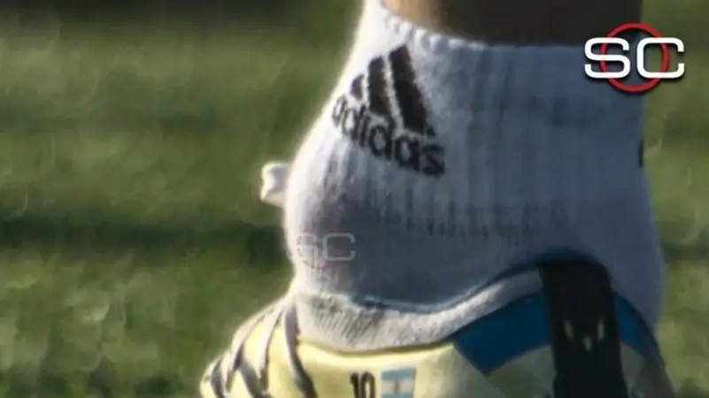 كاحل ميسي يثير الشكوك قبل مباراة