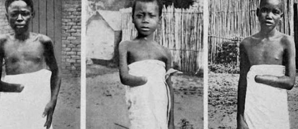 راح ضحيته أكثر من 10 ملايين