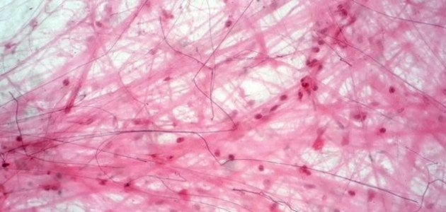 المرأة والنسيج الضام.. . ما هو