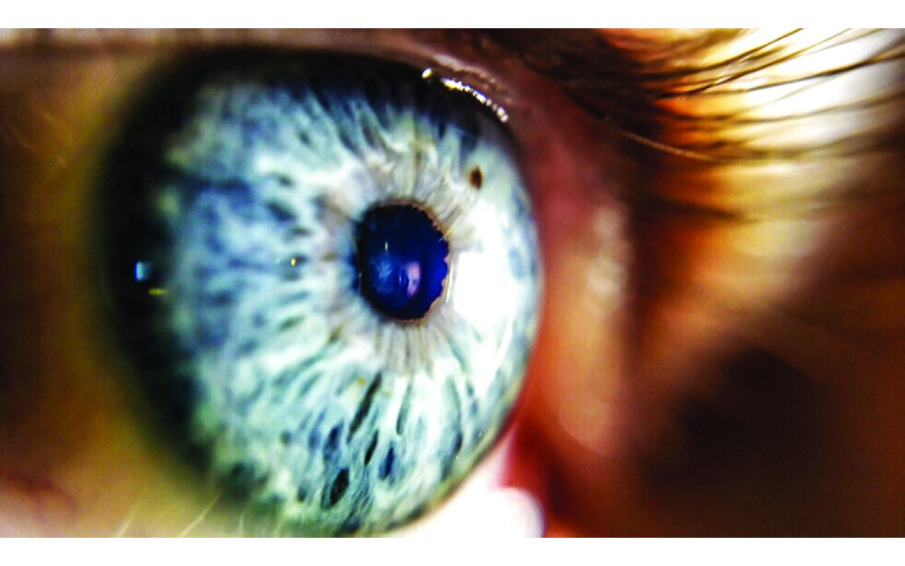 أنسجة عين مطبوعة