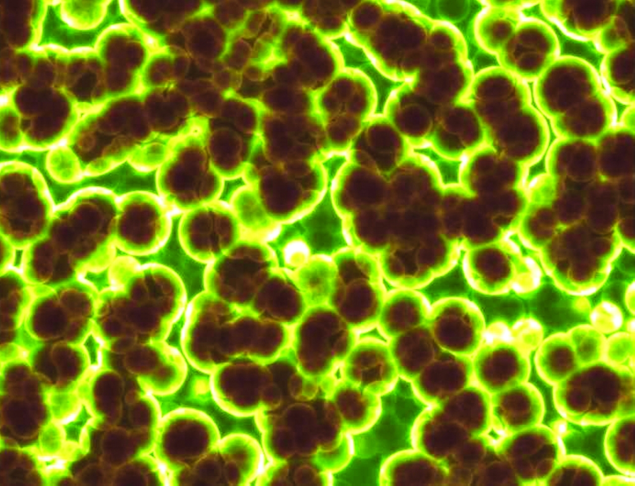 إنزيم في بكتيريا التربة يحول الهواء