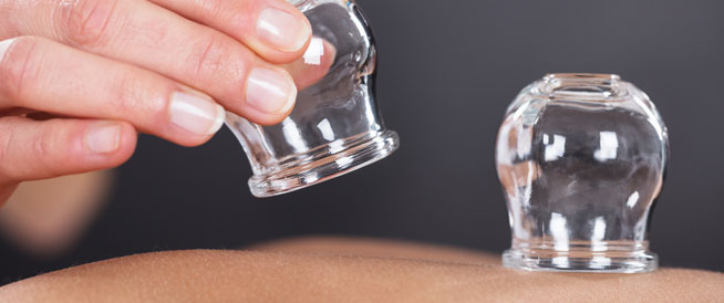 ما حكم حجامة المرأة للرجل الأجنبي