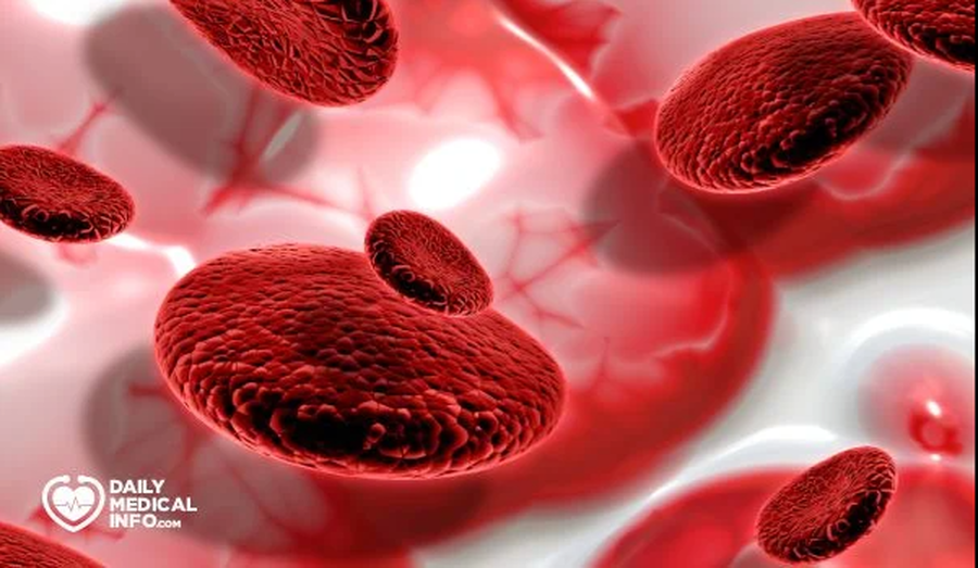 تعرف كيف ترفع مخزون الحديد بسرعة